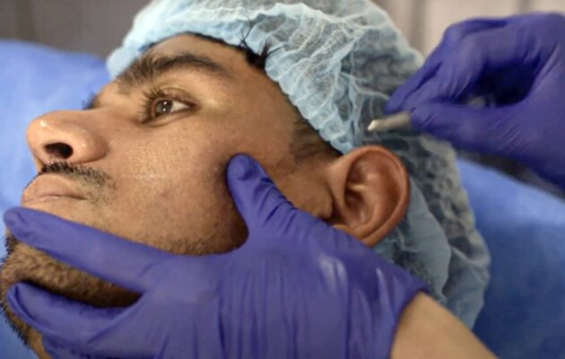 ARMONIZACIÓN FACIAL