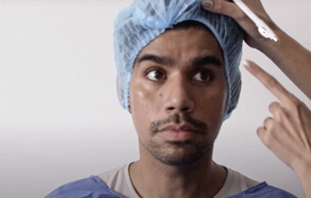 ARMONIZACIÓN FACIAL