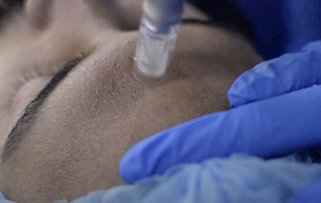 ARMONIZACIÓN FACIAL