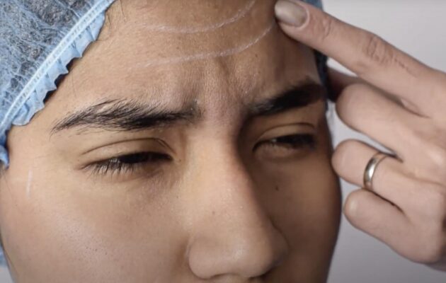 ARMONIZACIÓN FACIAL