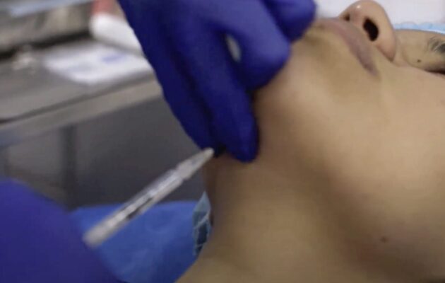 ARMONIZACIÓN FACIAL