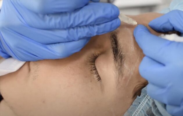 ARMONIZACIÓN FACIAL