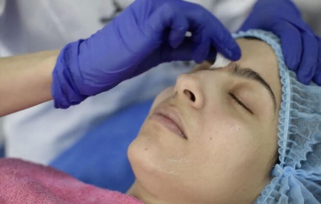 ARMONIZACIÓN FACIAL