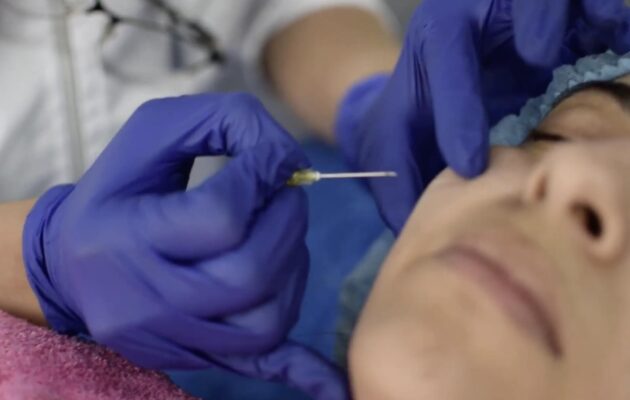 ARMONIZACIÓN FACIAL