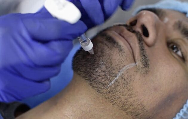 ARMONIZACIÓN FACIAL