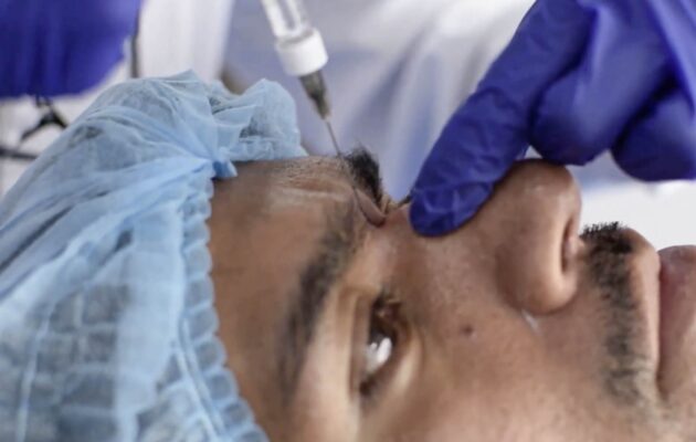 ARMONIZACIÓN FACIAL