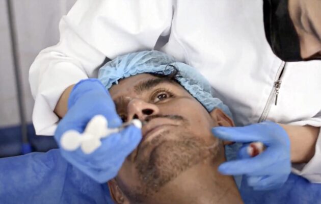 ARMONIZACIÓN FACIAL