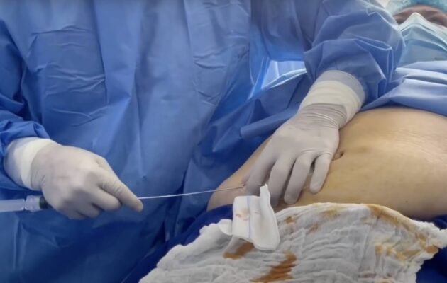 CÉLULAS MADRE APLICACIÓN ESTÉTICA 2