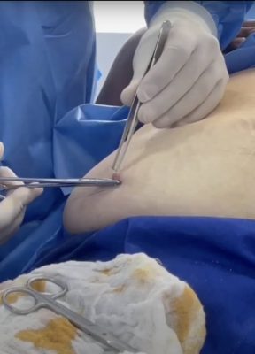 CÉLULAS MADRE APLICACIÓN ESTÉTICA 3