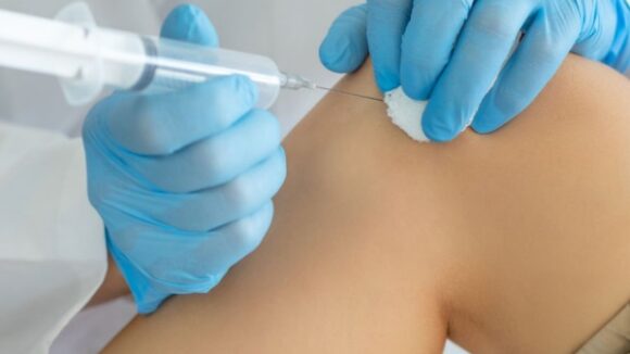 GELIFICACIÓN DE PLASMA INTRAARTICULAR