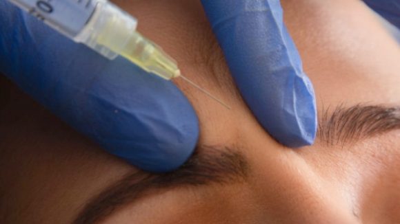 MASTERCLASS BIOESTIMULADORES DE COLÁGENO