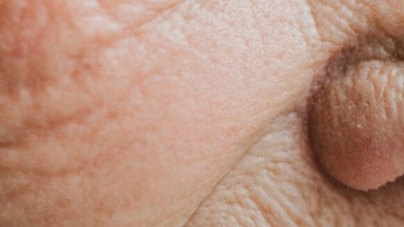 MASTERCLASS CÉLULAS MADRE EXOSOMAS FACIALES