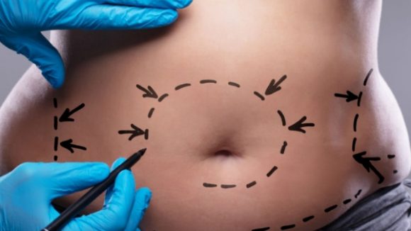 MASTERCLASS ELIMINACIÓN DE GRASA LOCALIZADA CON SUEROTERAPIA