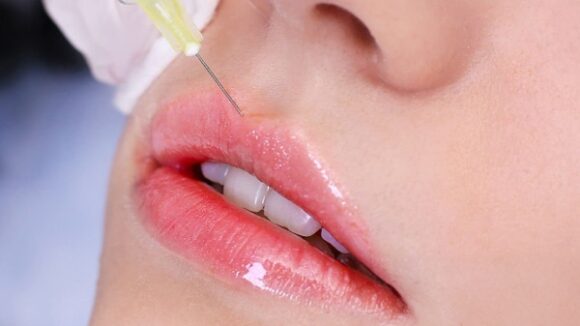 MASTERCLASS TÉCNICA DE INYECCIÓN EN LABIOS CON JERINGAS Y CÁNULAS